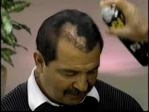 1990's INFOMERCIAL HELL #19: Spray paint the bald away with GLH, by Ronco, of course!