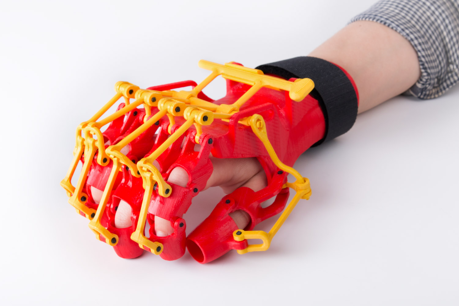 3D_Printed_Rehabilitation_Orthosis_Design_01.jpg