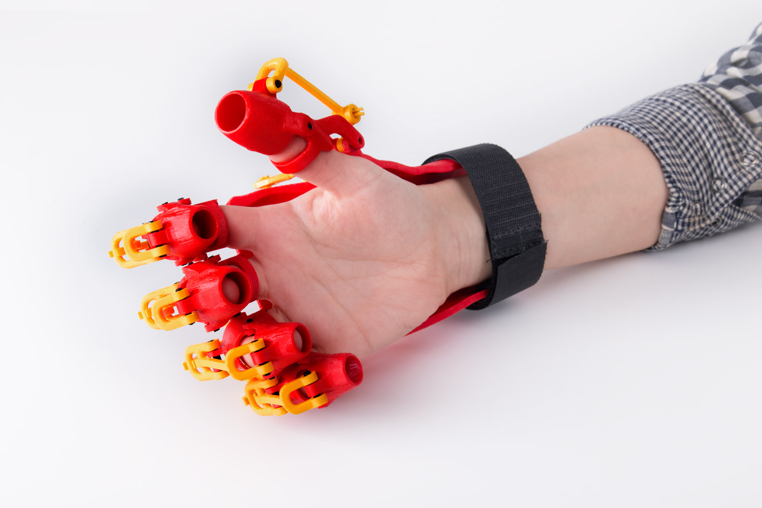 3D_Printed_Rehabilitation_Orthosis_Design_02.jpg