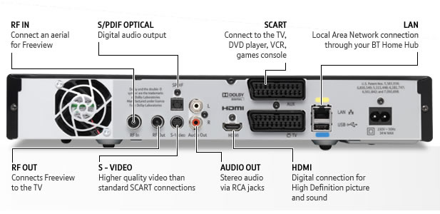 BT-Vision-V-box 2.jpg