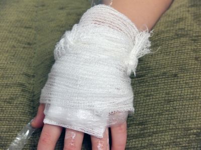 Bandaged_hand.jpg