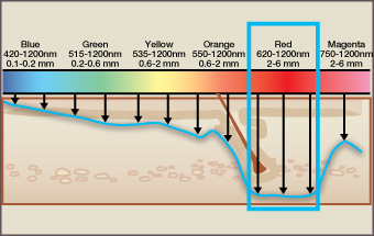 BenefitsofIPL_Wavelength.jpg