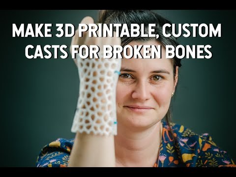 Custom, 3D Printable Arm Cast Tutorial in Rhino 3D &amp;amp; Grasshopper