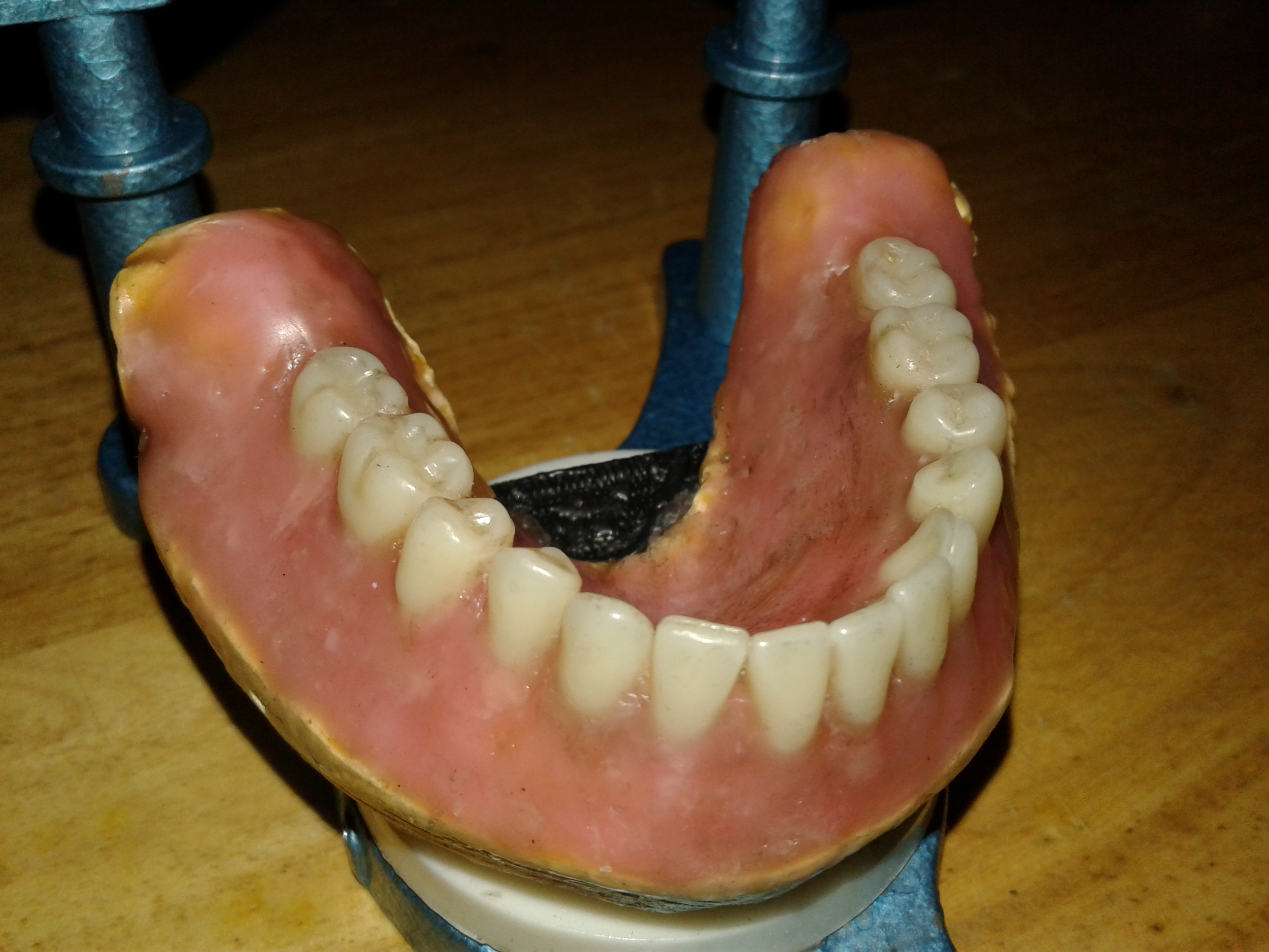 DentureInstructable014.jpg