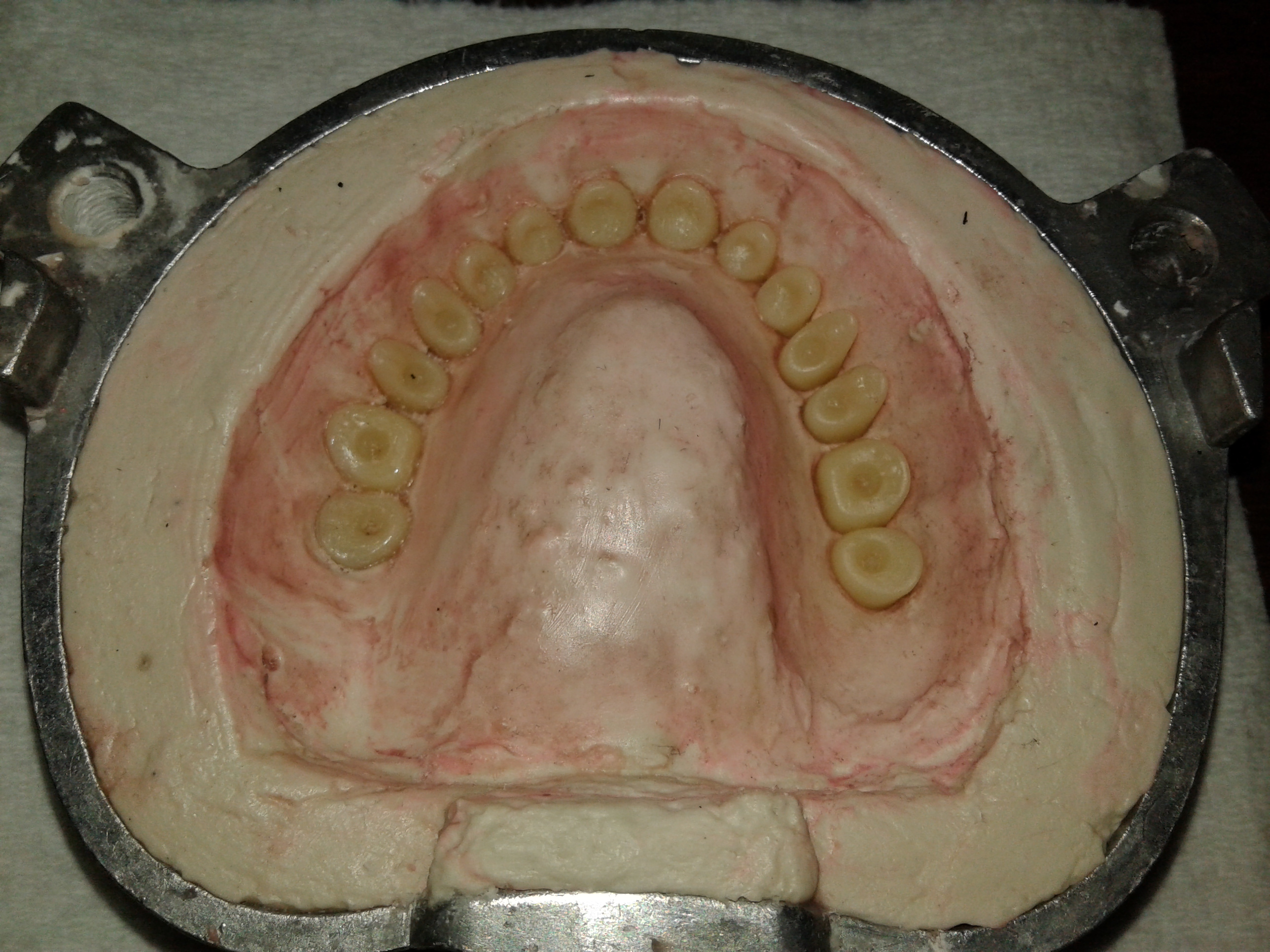 DentureInstructable021.jpg