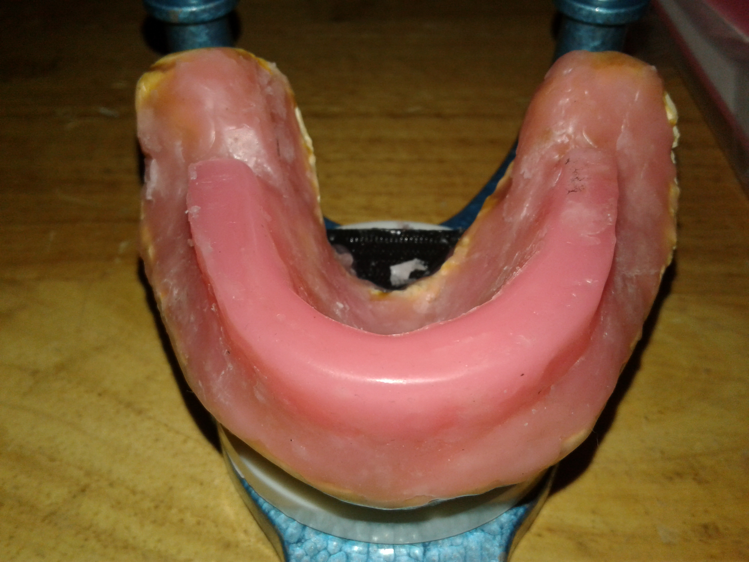 DentureInstructable09.jpg