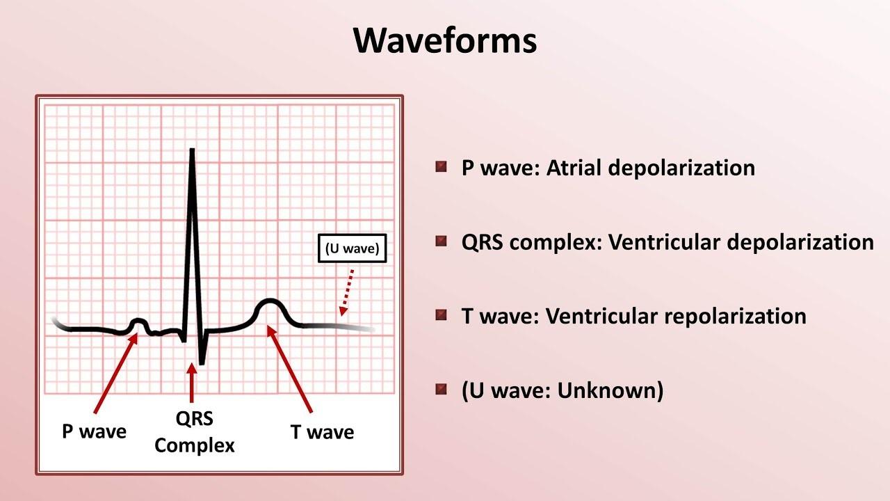 ECGgraphic.jpg