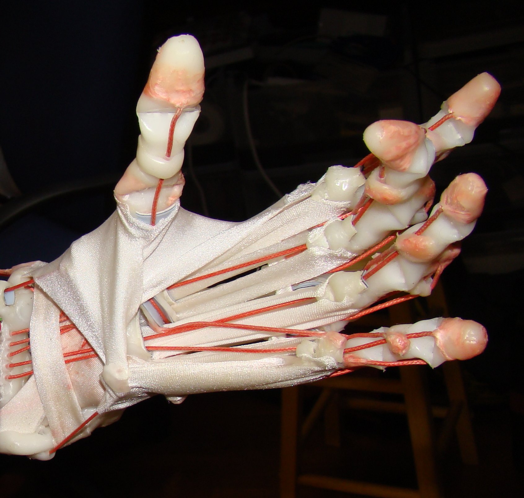 EDS Hand1.jpg