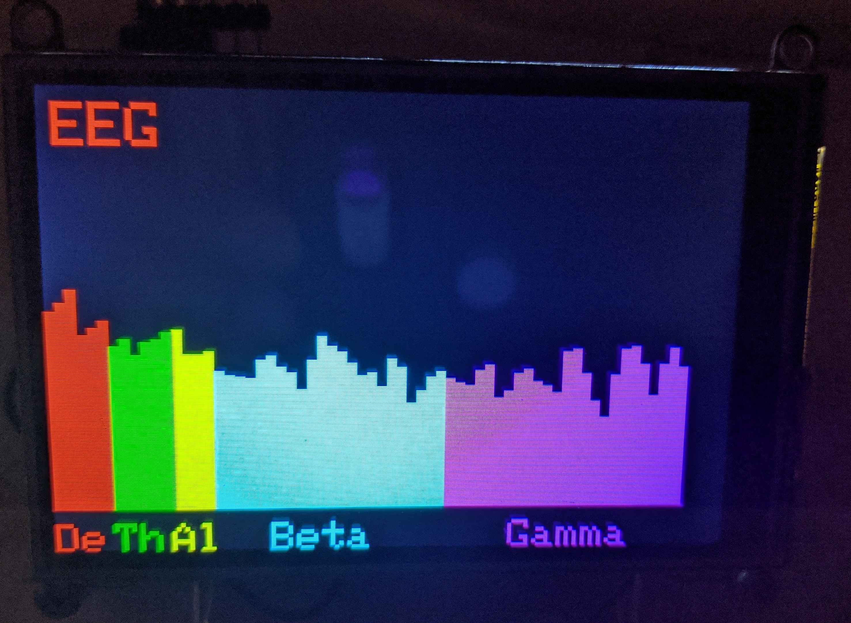 EEG_AD8232.jpg