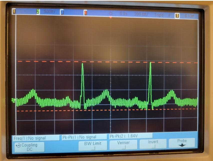 Final ECG wave.jpg