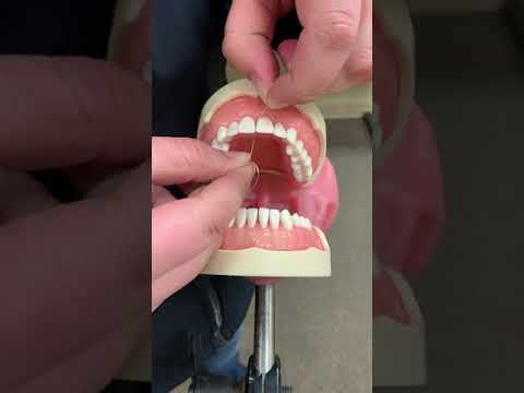 Flossing