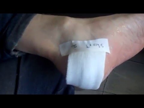 How to Properly apply a  wound dressing