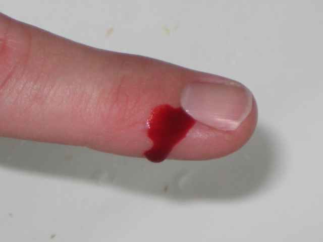 How to Treat a Cut Finger.jpg