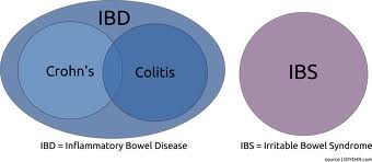 IBD Diagram.jpg