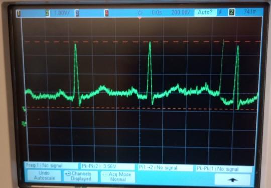 OSCILLISCOPE SIGNAL.jpg