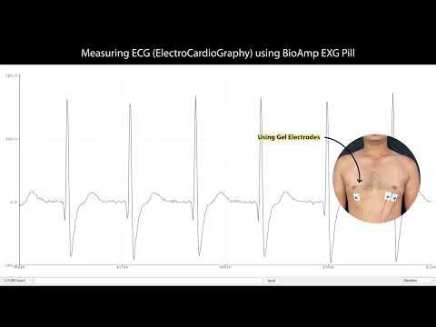 Record publication grade ECG at your home using BioAmp EXG Pill