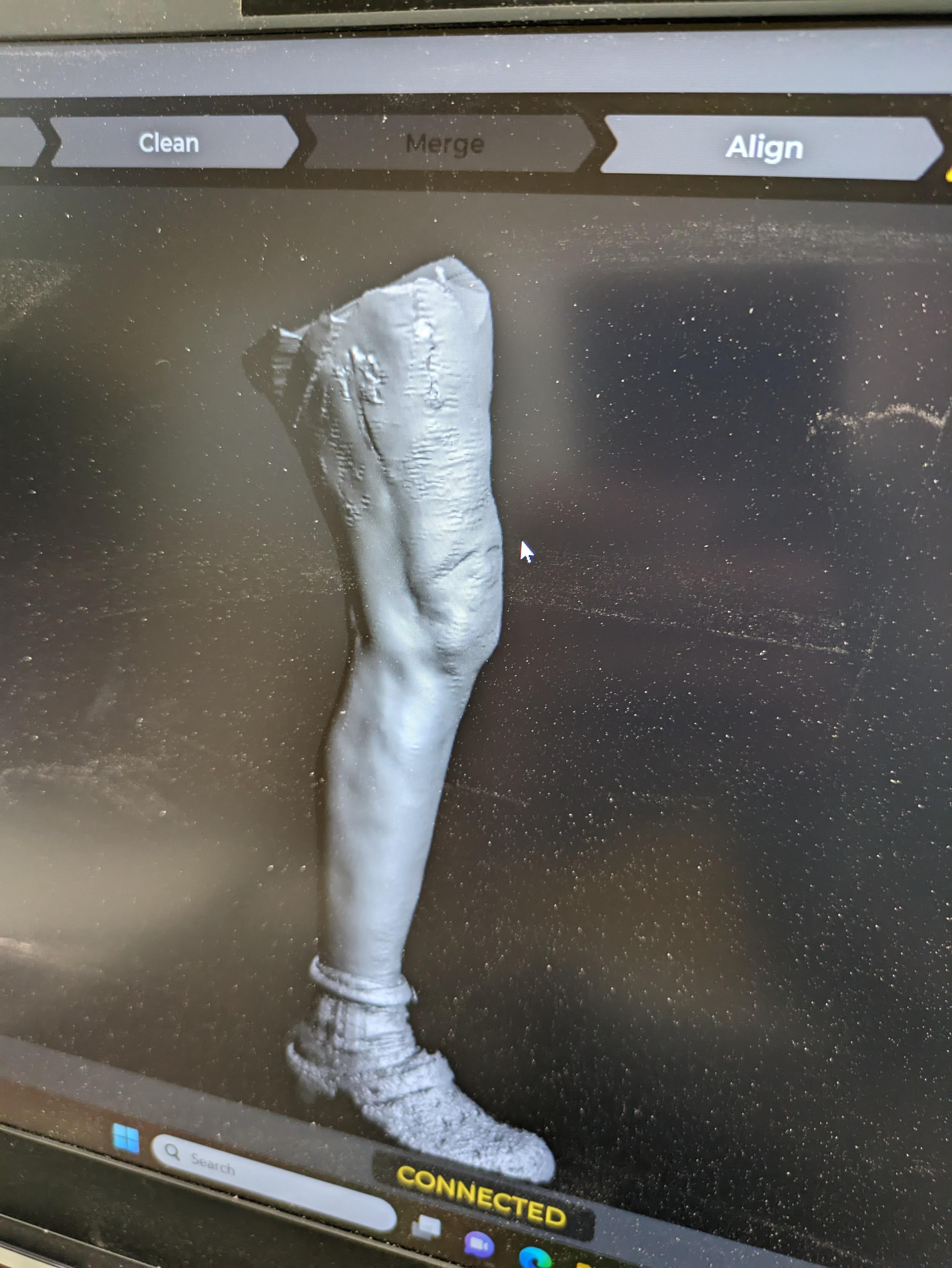 Scan of leg.jpg