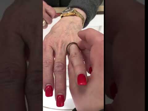 Sizing a ring example too big