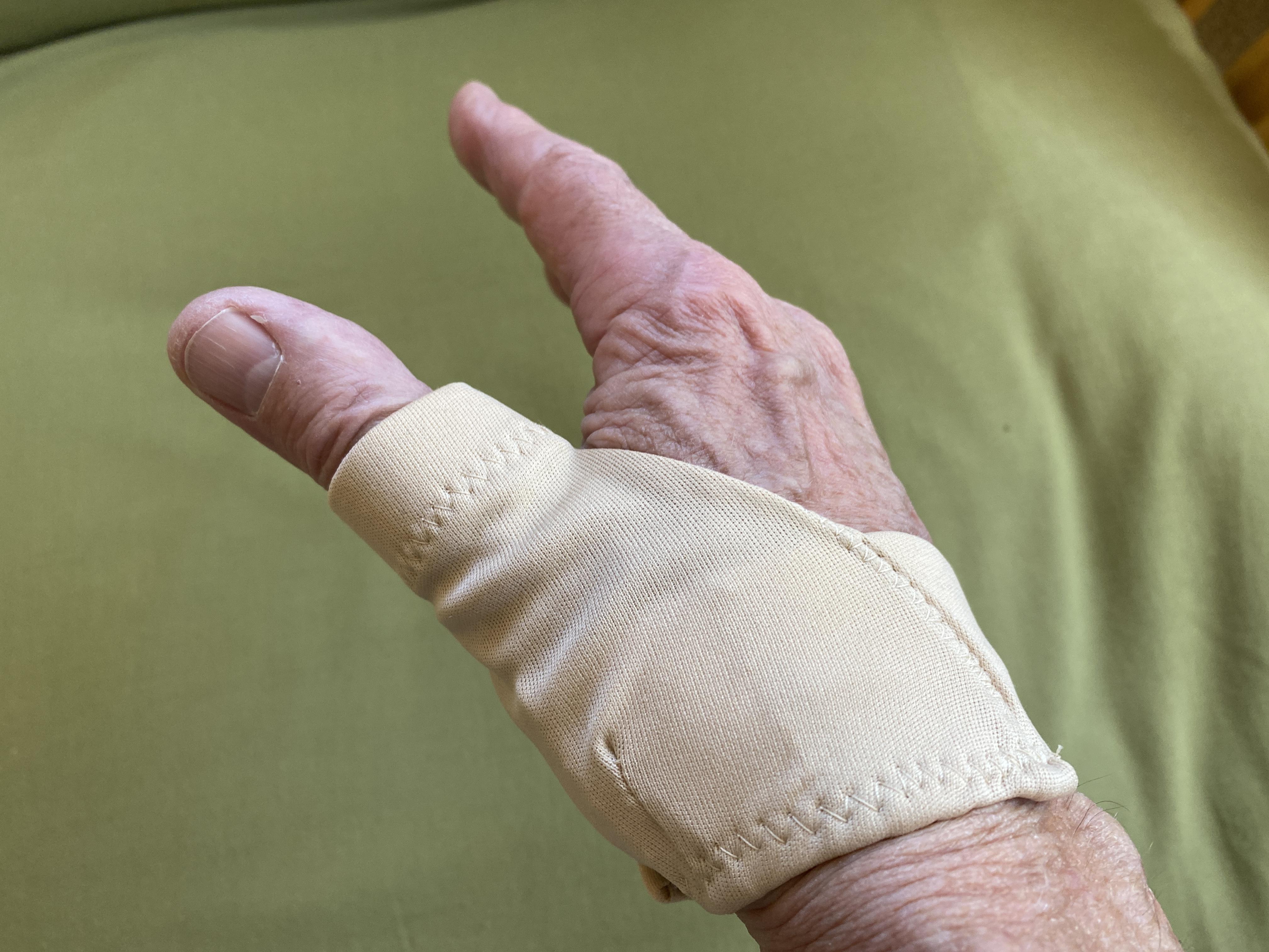 Splint(88).JPG