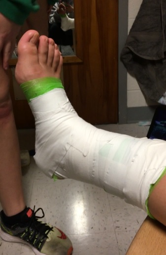 Tape Ankle.jpg