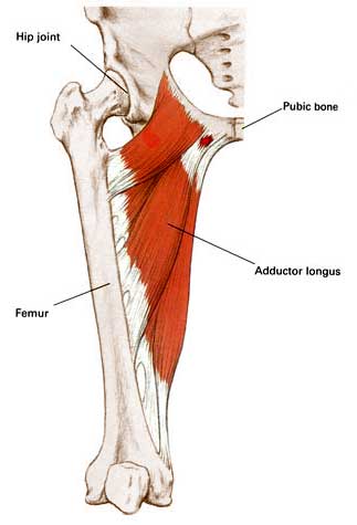 adductortendinopathy[1].jpg