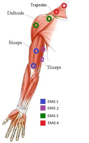 arm muscles with electrode placement 2.jpg