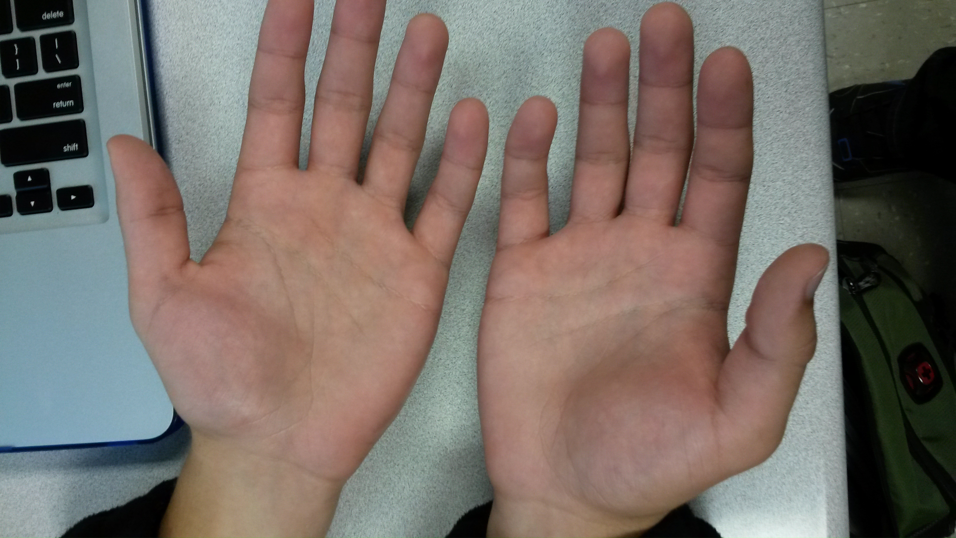 clamy hands.jpg