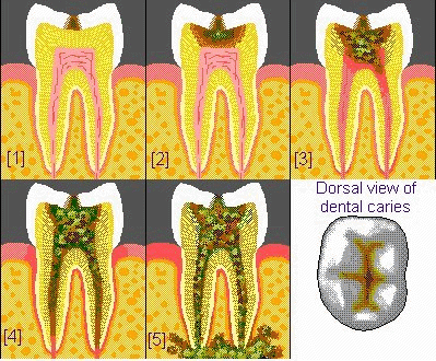 dentalca.gif