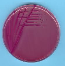 e coli cultivo.jpg