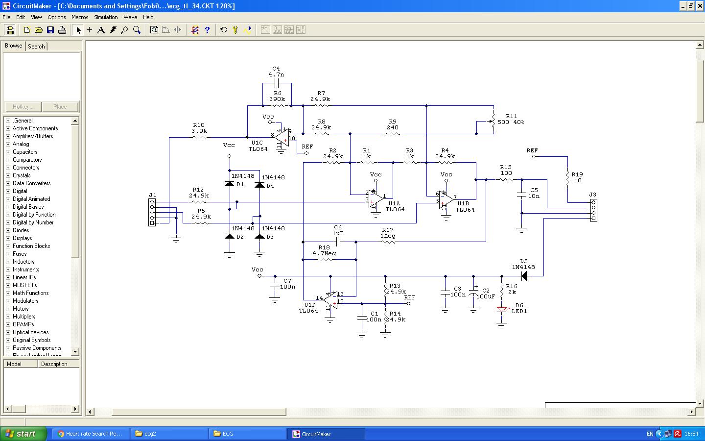 ecg2.JPG