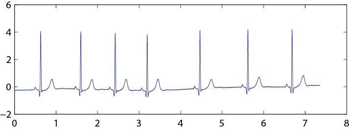 ecgMatlab.png