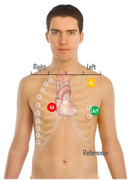 electrodes.jpg