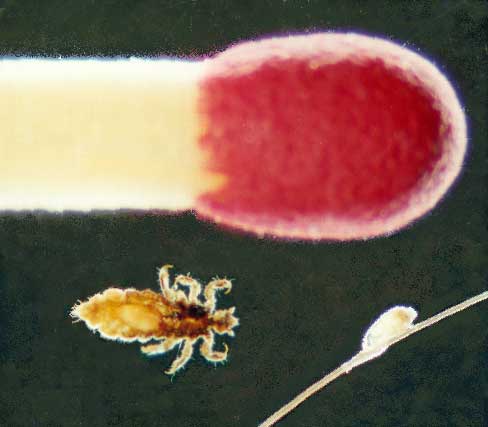 louse-photo.jpg