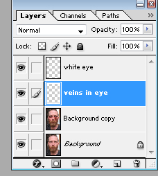 newlayer vein in eye.jpg