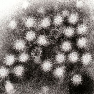 norovirus-norwalk-babson-college-flu_1.jpg