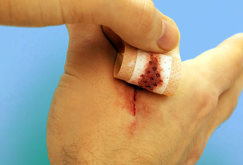 photolibrary_rf_photo_of_peeling_bandage_off_cut.jpg