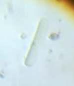 rod shaped algae.png