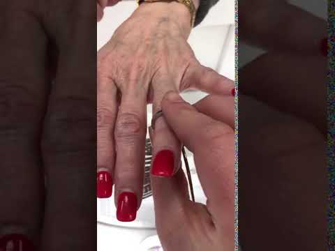 sizing a a finger for a ring too small