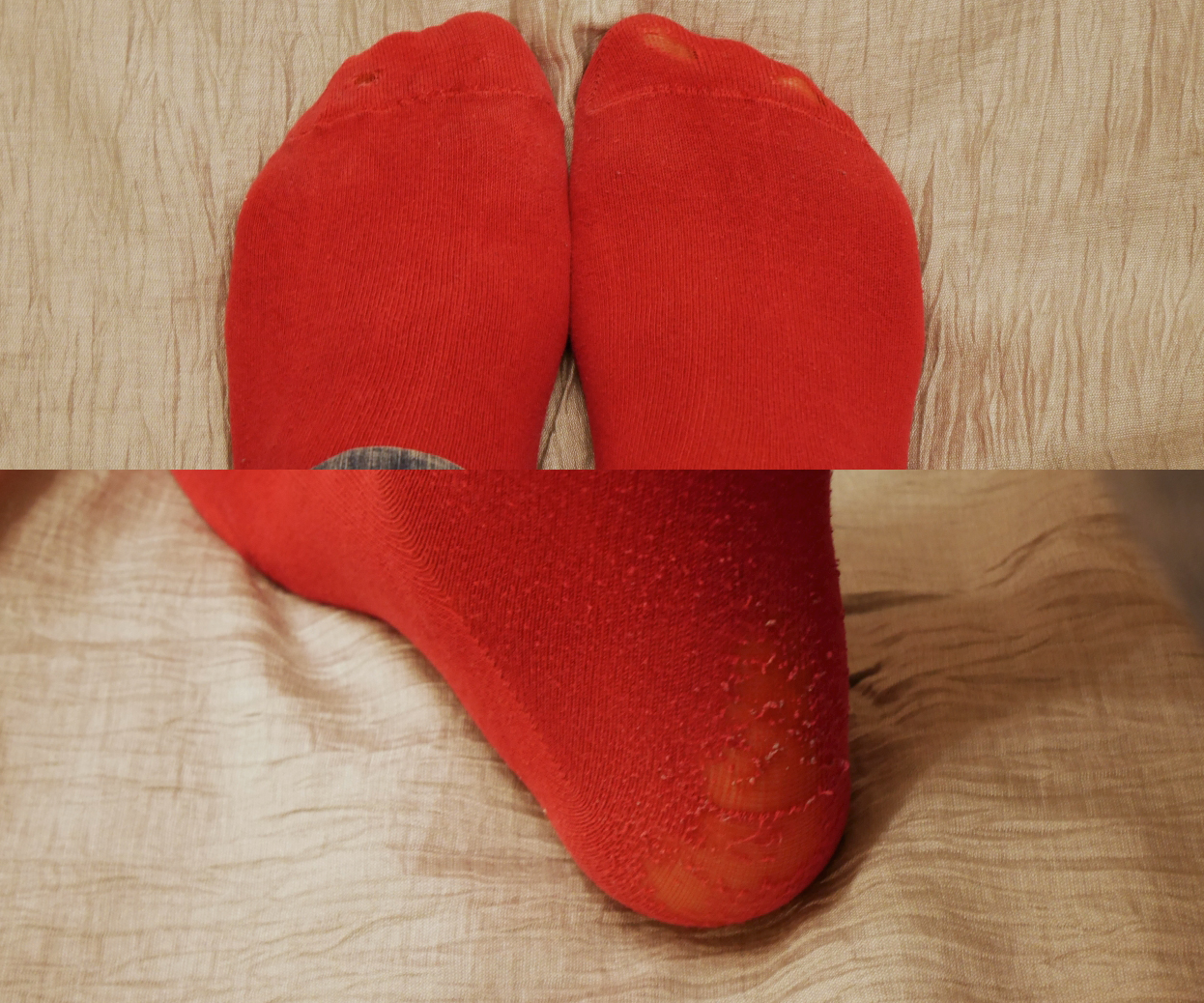 sock repair fix trial broken socks sun.jpg