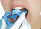 teeth-whitening-step1.jpg