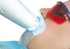 teeth-whitening-step4.jpg