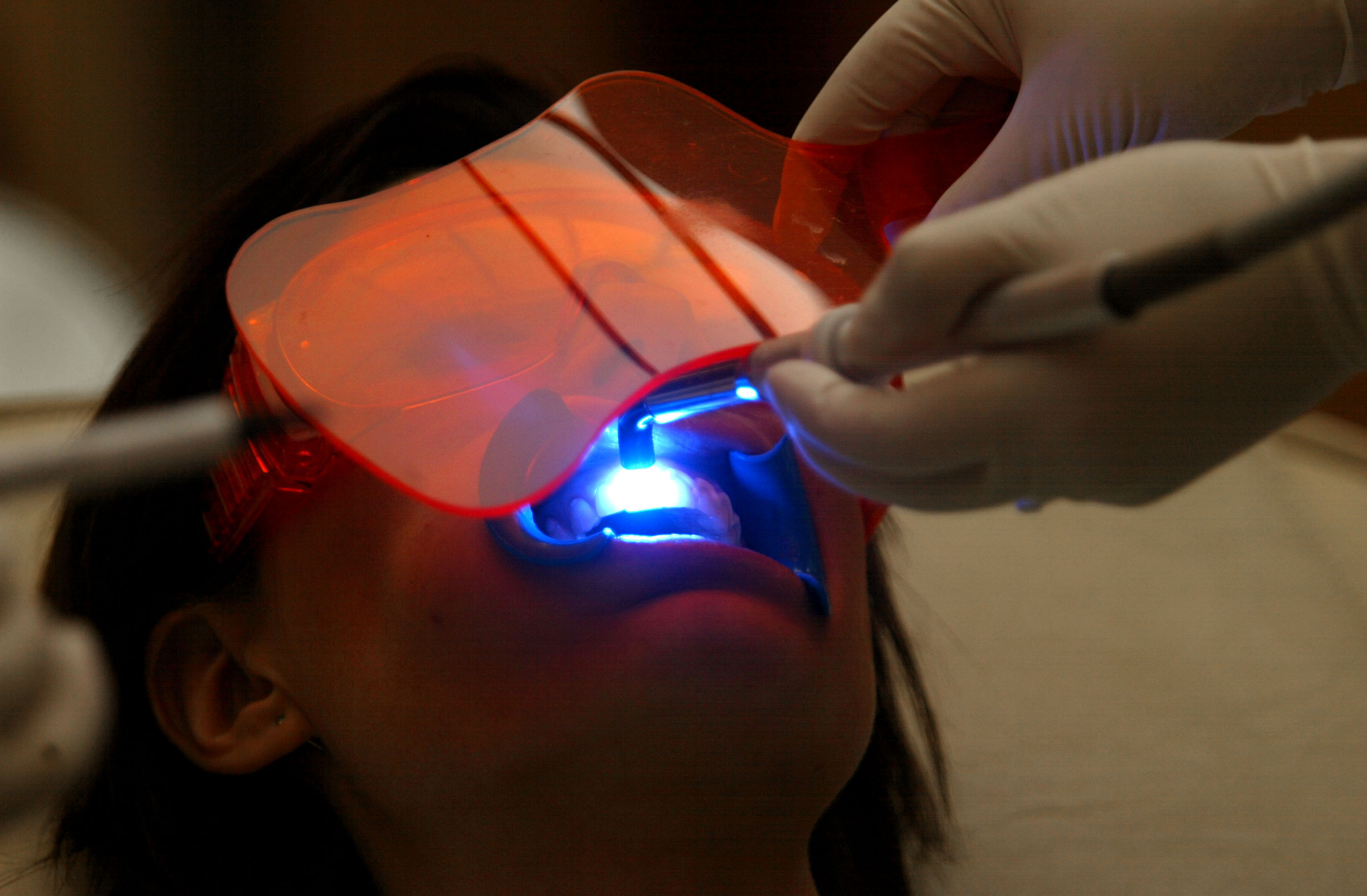 ultraviolet-uv-teeth-whitening.jpg