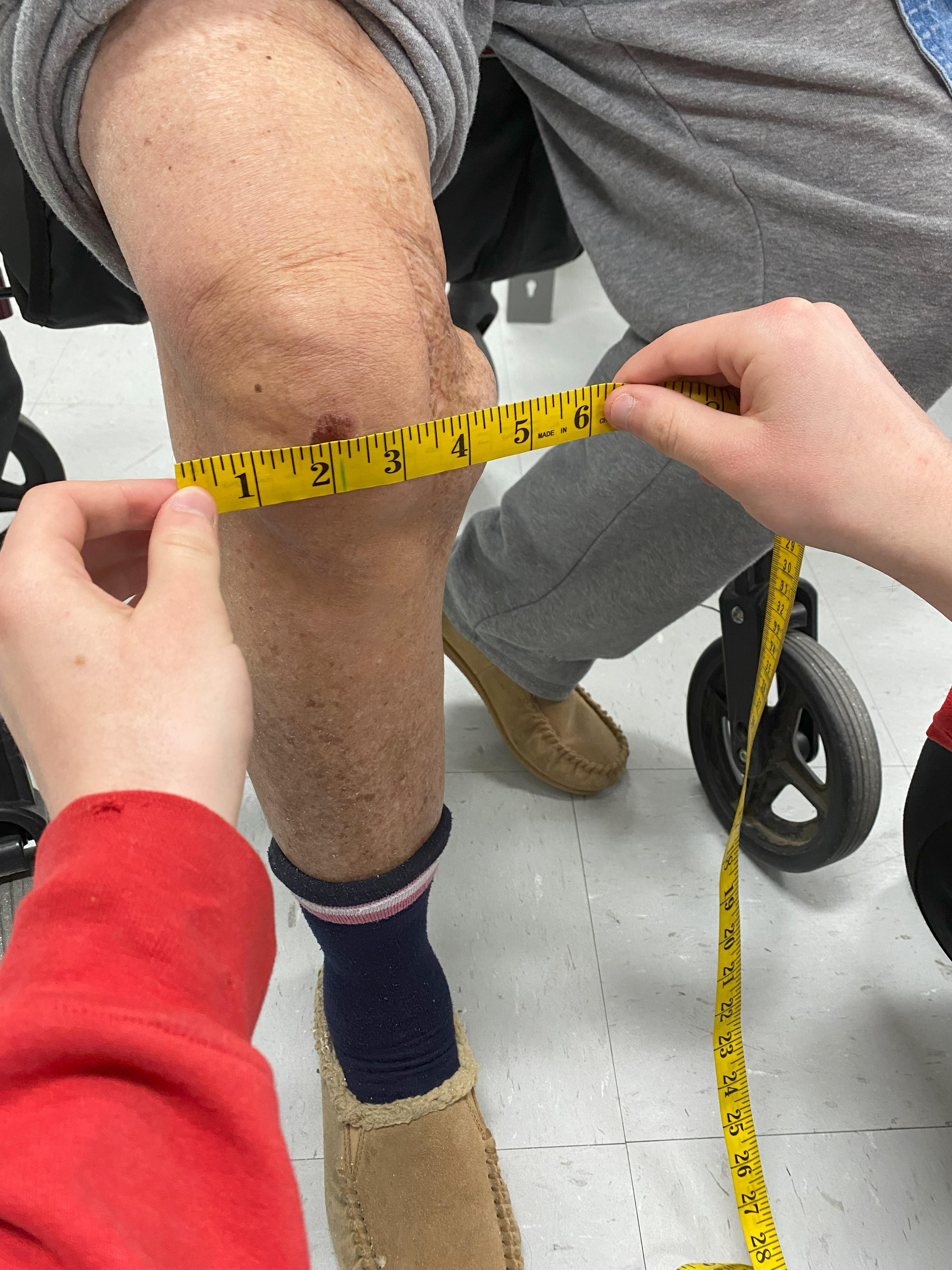 width of knee.jpg