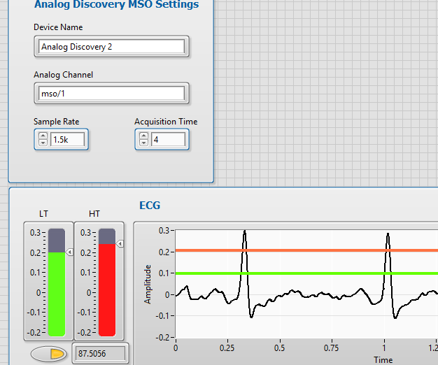 DIY ECG Using a Analog Discovery 2 and LabVIEW