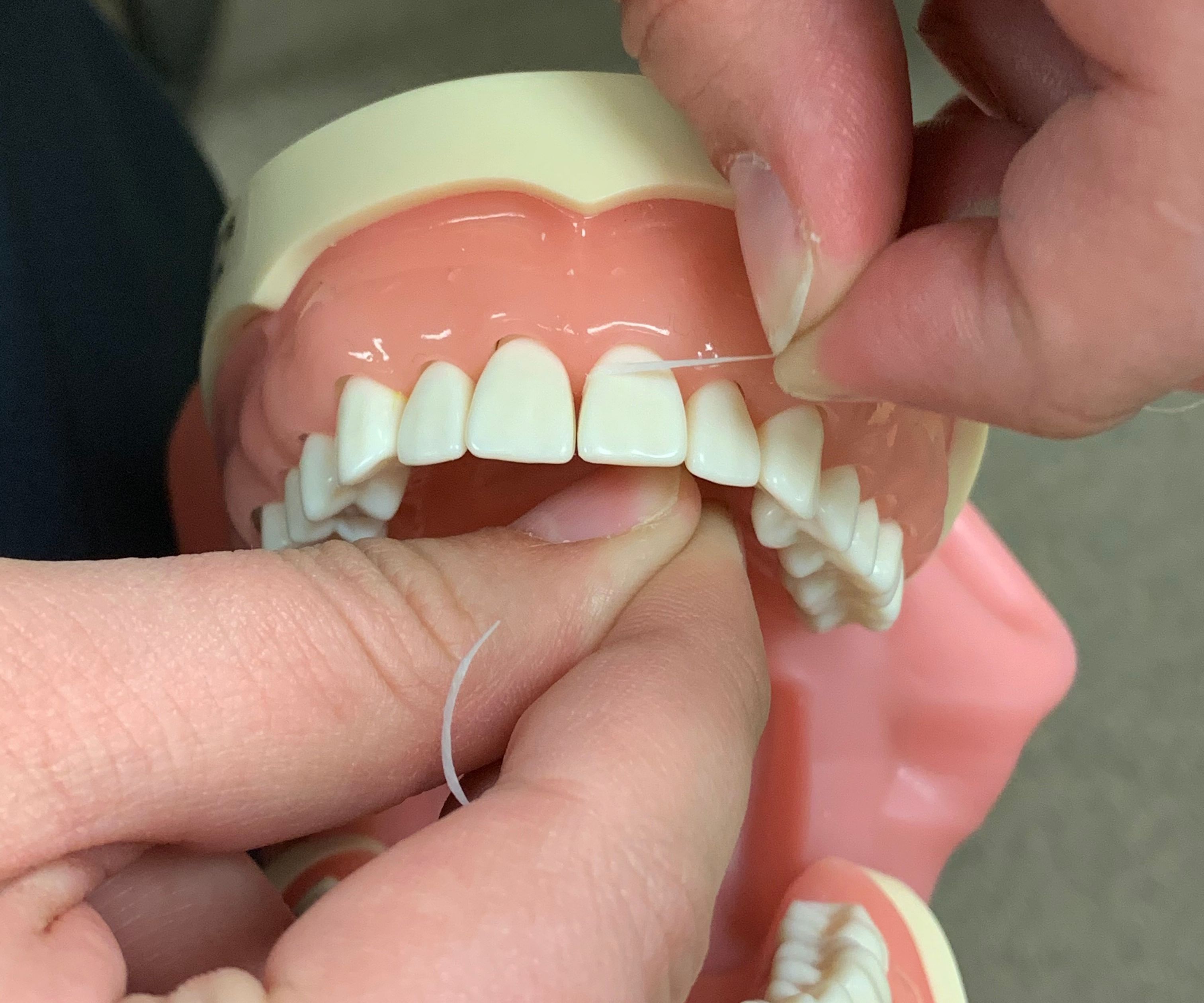 Flossing