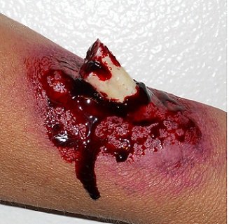 Make a Realistic Makeup Compound Fracture